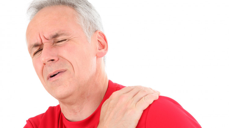 Impingement Syndrom der Schulter