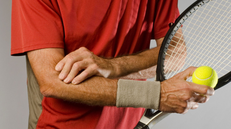 Tennisarm / Tennisellbogen (Epicondylitis lateris)
